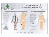 Электрифицированный стенд "Остановка кровотечения" - «globural.ru» - Сыктывкар
