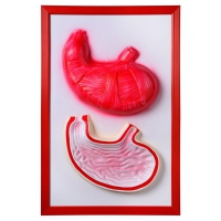 Барельефная модель "Желудок" - «globural.ru» - Сыктывкар