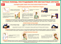 Таблица Порядок действий при опасном кровотечении 1000*1400 винил - «globural.ru» - Сыктывкар