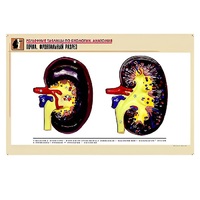 Рельефная таблица "Почка. Фронтальный разрез" (формат А1, матовое ламинир.) - «globural.ru» - Сыктывкар